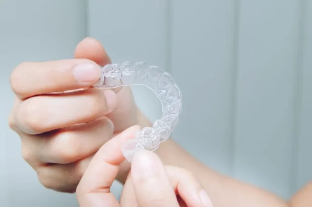 専門医によるナイトガードのご提供